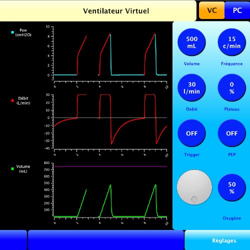 ventiSim